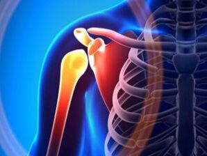 Inflamed taktak gabungan alatan arthrosis - kasakit kronis sistem musculoskeletal