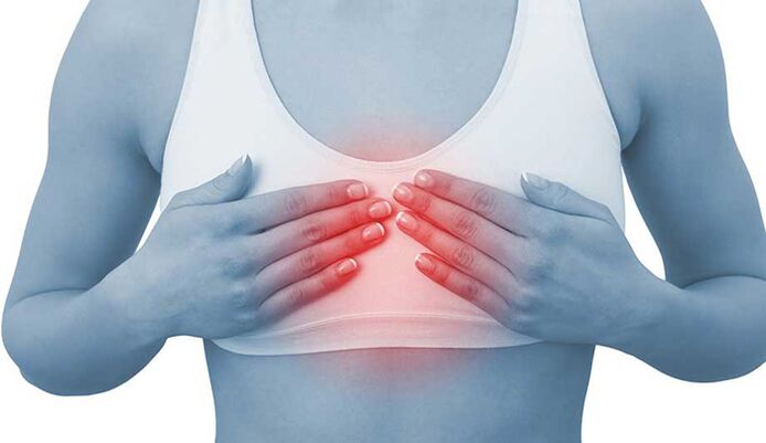 Nyeri pikeun chondrosis dada tiasa niru nyeri jantung
