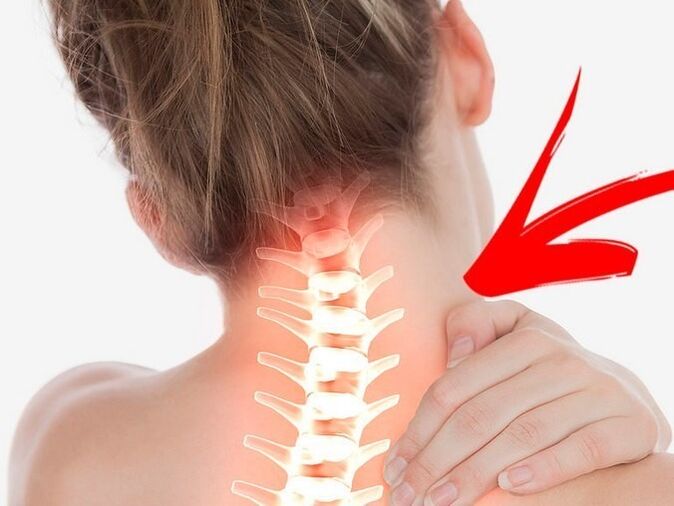 Komprési tina akar saraf sareng osteochondrosis cervical