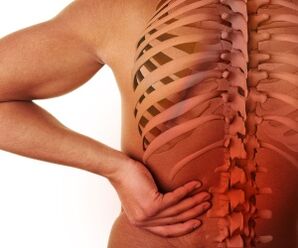 nyeri deui kalawan osteochondrosis lumbar
