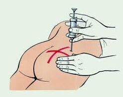 suntik pikeun pengobatan osteochondrosis