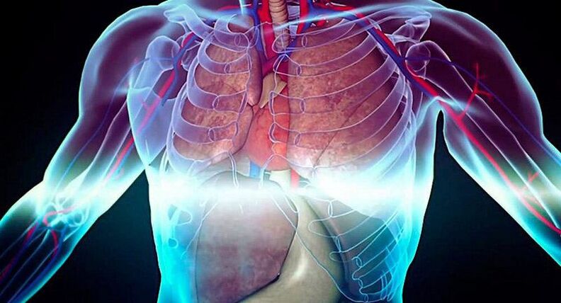 neuralgia intercostal